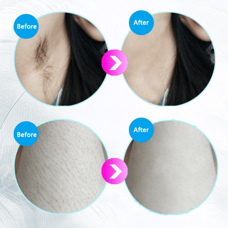 IPL Laser Hair Removal Handset – Painless At-Home Hair Remover for Women & Men