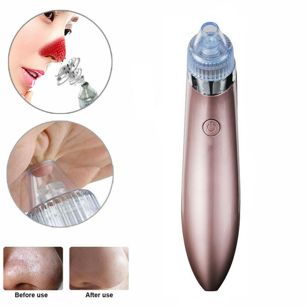 Electric Blackhead Remover Vacuum – Pore Cleaner & Acne Extractor with Suction
