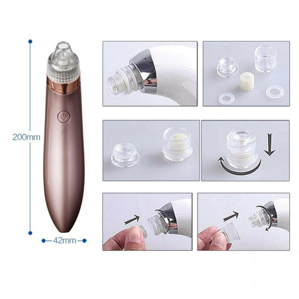 Electric Blackhead Remover Vacuum – Pore Cleaner & Acne Extractor with Suction