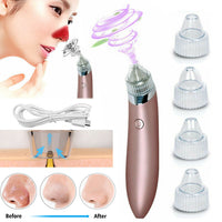 Electric Blackhead Remover Vacuum – Pore Cleaner & Acne Extractor with Suction