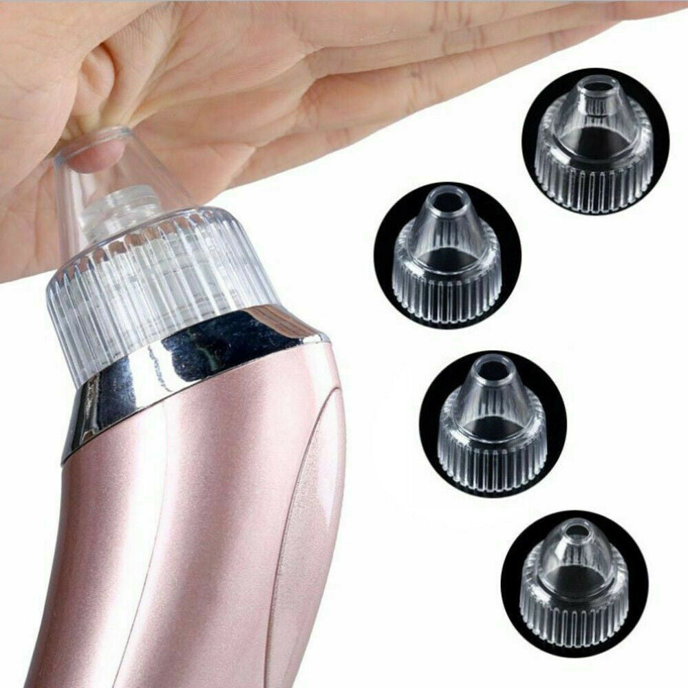 Electric Blackhead Remover Vacuum – Pore Cleaner & Acne Extractor with Suction