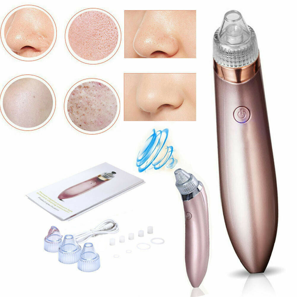 Electric Blackhead Remover Vacuum – Pore Cleaner & Acne Extractor with Suction