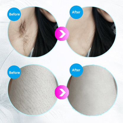 IPL Laser Hair Removal Handset – Painless At-Home Hair Remover for Women & Men