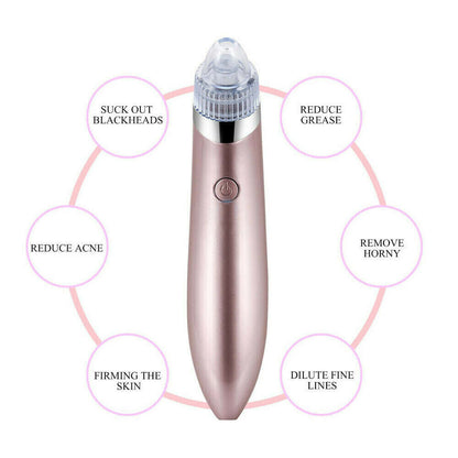 Electric Blackhead Remover Vacuum – Pore Cleaner & Acne Extractor with Suction