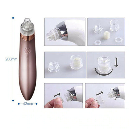 Electric Blackhead Remover Vacuum – Pore Cleaner & Acne Extractor with Suction