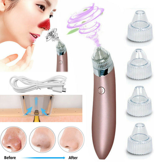 Electric Blackhead Remover Vacuum – Pore Cleaner & Acne Extractor with Suction